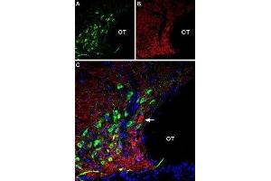 Multiplex staining of AT2 Receptor and VGLUT2 in rat supraoptic hypothalamic nucleus - Immunohistochemical staining of perfusion-fixed frozen rat brain sections using Anti-Angiotensin II Receptor Type-2 (extracellular)-ATTO Fluor-488 Antibody (ABIN7042926), (1:60) and Anti-VGLUT2-ATTO Fluor-594 Antibody (ABIN7043682), (1:60).