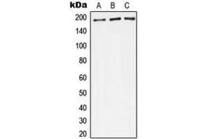 Western blot analysis of Complement C4A/B expression in A549 (A), Raw264. (Complement C4A/C4B (Center) anticorps)