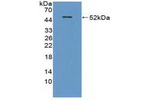 Western blot analysis of recombinant Mouse CRAT. (CRAT anticorps  (AA 1-430))