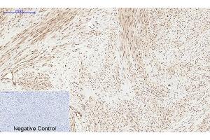 Immunohistochemical analysis of paraffin-embedded human uterus tissue.