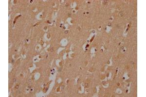 IHC image of ABIN7174973 diluted at 1:200 and staining in paraffin-embedded human brain tissue performed on a Leica BondTM system. (Myosin XV (MYO15) (AA 237-451) anticorps)