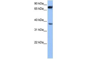WB Suggested Anti-ZCCHC12 Antibody Titration: 0. (ZCCHC12 anticorps  (N-Term))