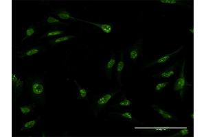 Immunofluorescence of monoclonal antibody to SUMO3 on HeLa cell. (SUMO3 anticorps  (AA 1-103))