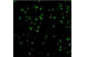 Immunofluorescence of ASK1 in 3T3 cells with AP30086PU-N ASK1 antibody at 20 μg/ml.