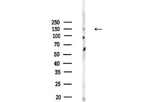 anti-Mitogen-Activated Protein Kinase Kinase Kinase 6 (MAP3K6) (C-Term) antibody