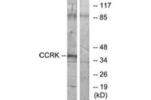 Western Blotting (WB) image for anti-Cyclin-Dependent Kinase 20 (CDK20) (AA 31-80) antibody (ABIN2889669) (CCRK anticorps  (AA 31-80))