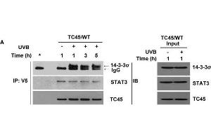 14-3-3σ transports TC45 into the keratinocyte nucleus following UVB irradiation through direct binding3PC keratinocytes overexpressing A.