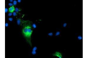 Anti-TCP11L2 mouse monoclonal antibody (ABIN2453719) immunofluorescent staining of COS7 cells transiently transfected by pCMV6-ENTRY TCP11L2 (RC207129). (TCP11L2 anticorps)