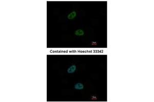 ICC/IF Image Immunofluorescence analysis of paraformaldehyde-fixed HeLa, using C20orf11, antibody at 1:1000 dilution. (GID8/C20orf11 anticorps  (Center))