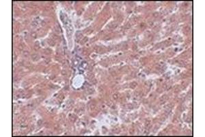 Immunohistochemistry of JMJD5 in rat liver tissue with this product at 2.
