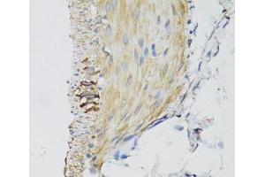 Immunohistochemistry of paraffin-embedded Mouse stomach using DGUOK Polyclonal Antibody at dilution of 1:100 (40x lens).