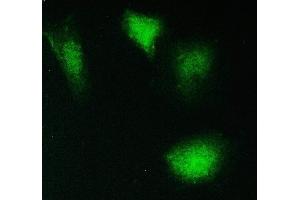 IF analysis of PPCS using anti-PPCS antibody (ABIN6719631). (PPCS anticorps)