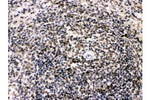 Immunohistochemistry (Paraffin-embedded Sections) (IHC (p)) image for anti-BCL2-Interacting Killer (Apoptosis-Inducing) (BIK) (AA 1-123) antibody (ABIN3043509)