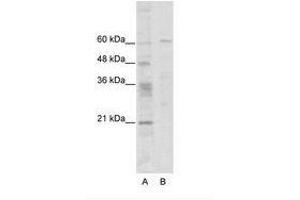 Image no. 1 for anti-Zinc Finger Protein 192 (ZNF192) (N-Term) antibody (ABIN6736101) (ZNF192 anticorps  (N-Term))