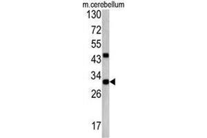 Western blot analysis: ZWINT Antibody staining of Mouse cerebellum tissue lysates (35ug/lane).