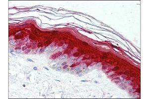 Immunohistochemistry (IHC) image for anti-S100 Calcium Binding Protein A7 (S100A7) antibody (ABIN400722) (S100A7 anticorps)