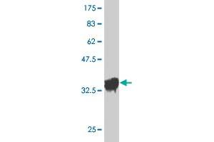 Western Blot detection against Immunogen (36. (OXSR1 anticorps  (AA 351-450))