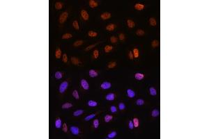 Immunofluorescence analysis of U2OS cells using CSTF2T Rabbit pAb (ABIN6131580, ABIN6139164, ABIN6139165 and ABIN6220675) at dilution of 1:100.