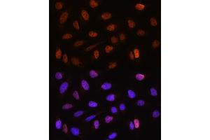 Immunofluorescence analysis of U2OS cells using CSTF2T Rabbit pAb (ABIN6131580, ABIN6139164, ABIN6139165 and ABIN6220675) at dilution of 1:100. (CSTF2T anticorps  (AA 420-560))