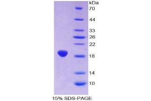 SDS-PAGE (SDS) image for Aconitase 1 (ACO1) (AA 669-834) protein (His tag) (ABIN1169746)