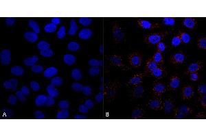 Immunocytochemistry/Immunofluorescence analysis using Mouse Anti-VPS35 Monoclonal Antibody, Clone 5A9 (ABIN6932932). (VPS35 anticorps)
