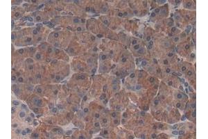 Detection of CTRB1 in Human Pancreas Tissue using Polyclonal Antibody to Chymotrypsinogen B1 (CTRB1)