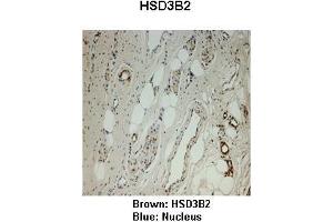 Sample Type :  Monkey vagina   Primary Antibody Dilution :   1:25   Secondary Antibody:  Anti-rabbit-HRP   Secondary Antibody Dilution:   1:1000   Color/Signal Descriptions:  Brown: HSD3B2 Blue: Nucleus   Gene Name:  HSD3B2   Submitted by:  Jonathan Bertin, Endoceutics Inc. (HSD3B2 anticorps  (N-Term))