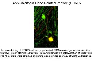 Immunocytochemistry of Anti-Calcitonin Gene Related Peptide (CGRP) (Mouse) Antibody - 200-301-D15 Immunocytochemistry of Anti-Calcitonin Gene Related Peptide (CGRP) (Mouse) Antibody. (CGRP anticorps)