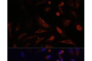 Immunofluorescence analysis of U2OS cells using CLDN5 Polyclonal Antibody at dilution of 1:100. (Claudin 5 anticorps)