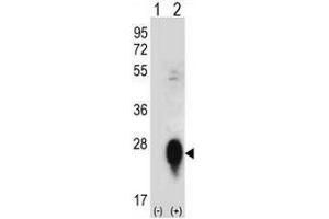 Western blot analysis of CLEC3B (arrow) using rabbit polyclonal CLEC3B Antibody (Center) . (CLEC3B anticorps  (Middle Region))