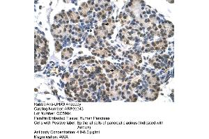 Human Pancreas (DHX9 anticorps  (N-Term))