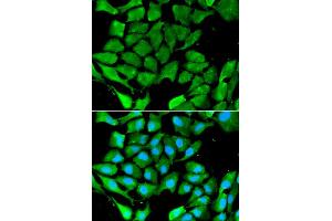 Immunofluorescence analysis of A549 cell using PPARG antibody. (PPARG anticorps)