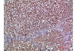 Immunohistochemical analysis of paraffin-embedded human-pancreas, antibody was diluted at 1:200