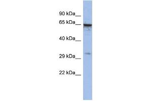 WB Suggested Anti-MAGEA9 Antibody Titration:  0. (MAGEA9 anticorps  (Middle Region))