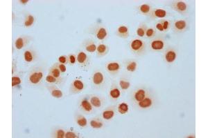 Immunocytochemistry analysis of ABIN7139596 diluted at 1:5 and staining in Hela cells performed on a Leica BondTM system.