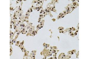 Immunohistochemistry of paraffin-embedded Rat lung using FGF2 Polyclonal Antibody at dilution of 1:100 (40x lens).