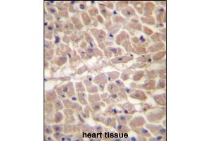 TRIM11 Antibody (C-term) (ABIN657207 and ABIN2846320) immunohistochemistry analysis in formalin fixed and paraffin embedded human heart tissue followed by peroxidase conjugation of the secondary antibody and DAB staining. (TRIM11 anticorps  (C-Term))