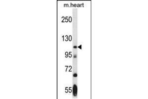 Western blot analysis in mouse heart tissue lysates (35ug/lane).