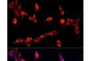 Immunofluorescence analysis of NIH/3T3 cells using CHAT Polyclonal Antibody at dilution of 1:100. (Choline Acetyltransferase anticorps)