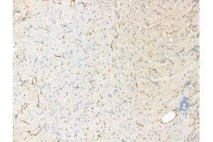 ABIN7094573 and ABIN7098622 at 1/100 staining Rat brain tissue by IHC-P.