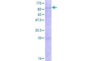 Image no. 1 for Acyl-CoA Binding Domain Containing 5 (ACBD5) (AA 1-490) protein (GST tag) (ABIN1305623)