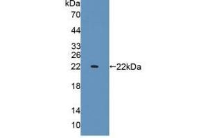 Western blot analysis of recombinant Rat IL1a. (IL1A anticorps  (AA 115-270))