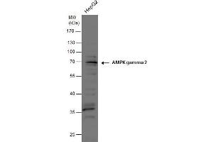 WB Image AMPK gamma 2 antibody detects AMPK gamma 2 protein by western blot analysis.