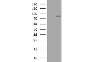 Image no. 1 for anti-Mitofusin 1 (MFN1) (AA 209-469) antibody (ABIN1491186) (MFN1 anticorps  (AA 209-469))