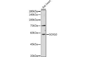 Western blot analysis of extracts of Rat heart, using SOX10 antibody (ABIN6134484, ABIN6148289 and ABIN7101829) at 1:1000 dilution. (SOX10 anticorps)