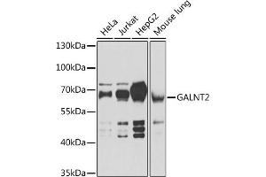 Western blot analysis of extracts of various cell lines, using G antibody (ABIN6133219, ABIN6140940, ABIN6140941 and ABIN6222644) at 1:1000 dilution. (GALNT2 anticorps  (AA 442-571))