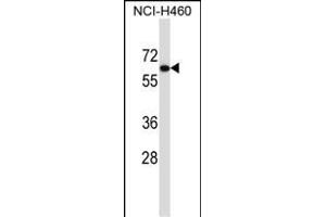 UGT2B11 Antibody (C-term) (ABIN657441 and ABIN2846471) western blot analysis in NCI- cell line lysates (35 μg/lane). (UGT2B11 anticorps  (C-Term))