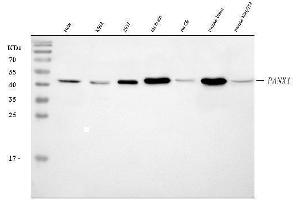 Western blot analysis of Pannexin 1/PANX1 using anti-Pannexin 1/PANX1 antibody (ABIN7599312).