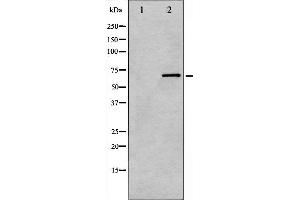 Western blot analysis of PKCB phosphorylation expression in heatshock treated HeLa whole cell lysates,The lane on the left is treated with the antigen-specific peptide. (PKC beta anticorps  (pSer661))