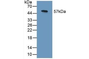 Detection of Recombinant SHC3, Human using Polyclonal Antibody to SHC-Transforming Protein 3 (SHC3)